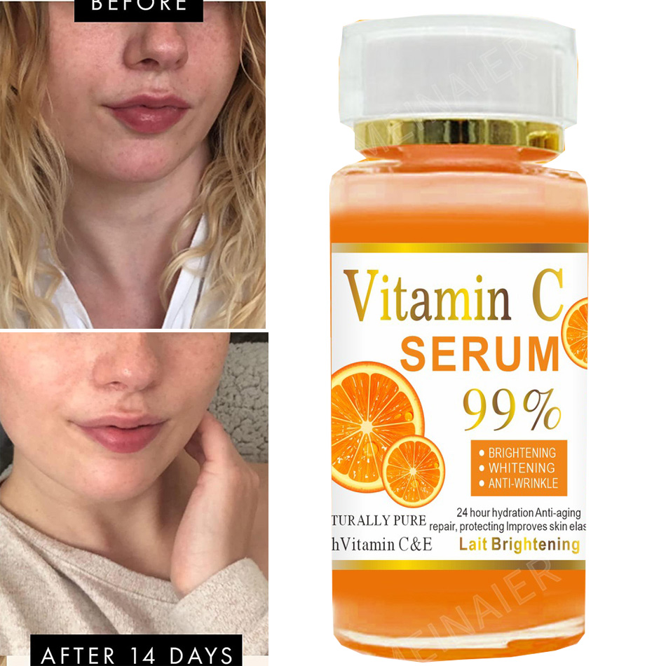 Exosome Serum Ampoule - เซรั่มวิตามินซี120มล. ต่อต้านริ้วรอยเพื่อผิวขาวเซรั่มบำรุงผิวหน้าไร้กาลเวลาเซรั่มต่อต้านริ้วรอยสำหรับจุดด่างดำบนใบหน้า