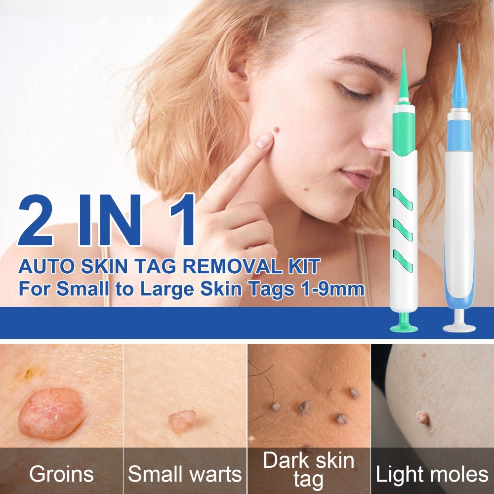 ชุดเครื่องมือกำจัดไฝ กำจัดสิว  - Luxury Skincare Acne บทวิจารณ์และราคา