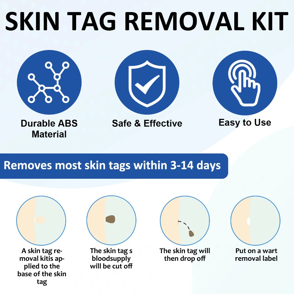 ชุดเครื่องมือกำจัดไฝ กำจัดสิว  - Luxury Skincare Acne บทวิจารณ์และราคา