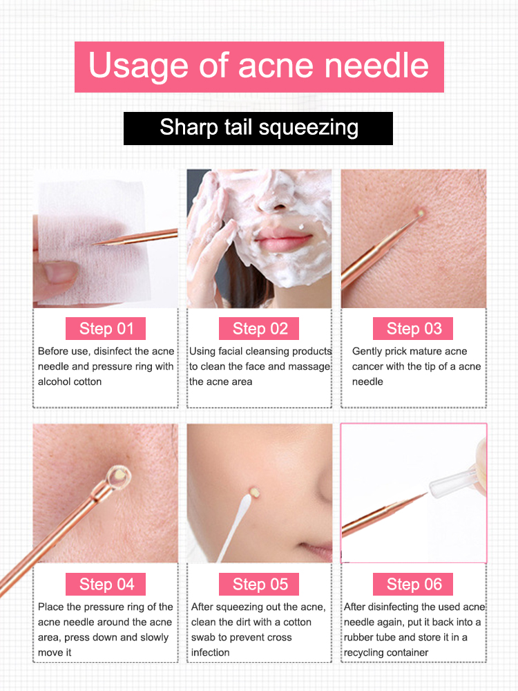 Blackhead Remover สิว Comedone - Luxury Skincare Acne บทวิจารณ์และราคา
