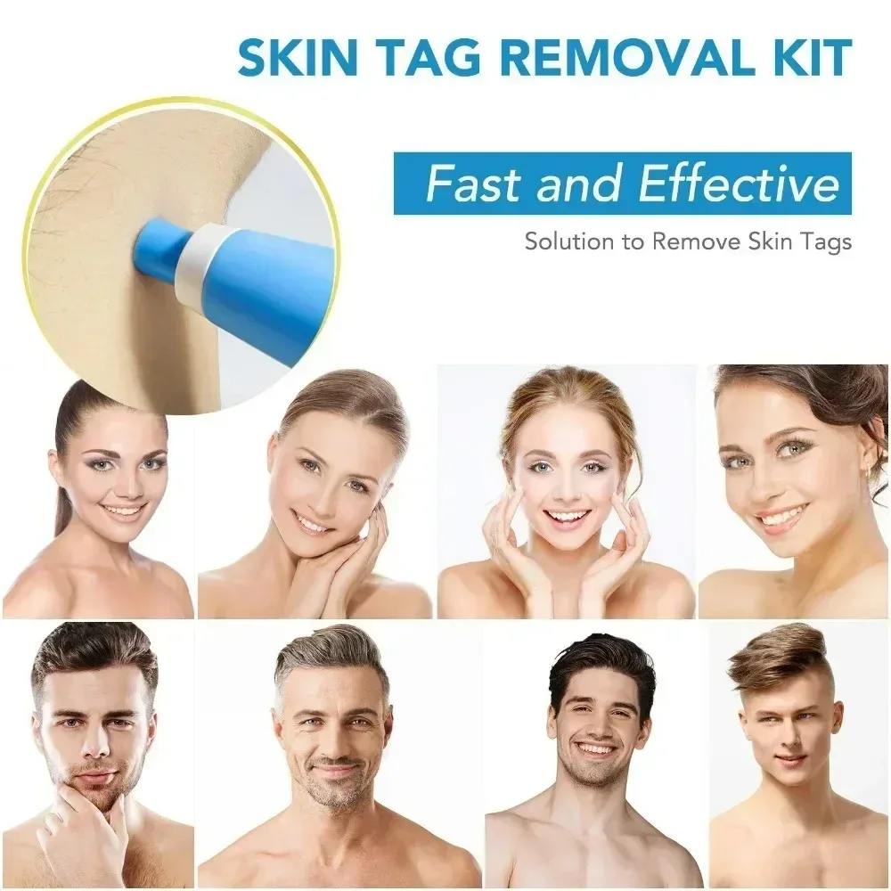 สิวRemover 2 IN 1 Auto Micro S - Luxury Skincare Acne บทวิจารณ์และราคา