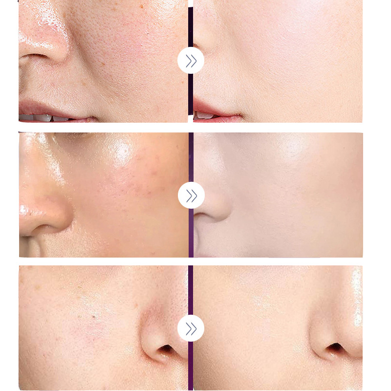 คอนซีลเลอร์บำรุงผิวหน้าครีมบำร - Luxury Skincare Cream บทวิจารณ์และราคา
