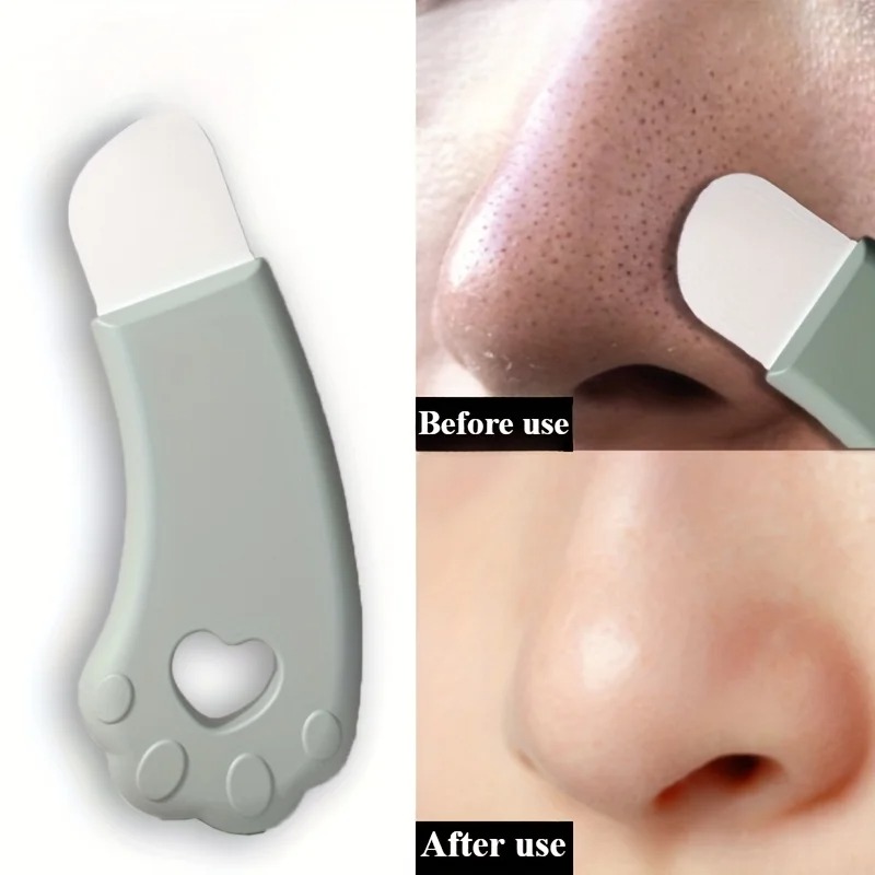 เครื่องมือกำจัดสิวเสี้ยนรูปอุ้ - Luxury Skincare Acne บทวิจารณ์และราคา