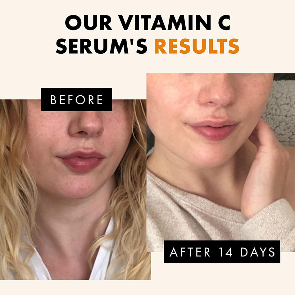 เซรั่มวิตามินซี120มล. ต่อต้านร - Exosome Serum Ampoule บทวิจารณ์และราคา